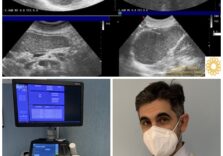 L’ospedale San Martino di Genova guarda al futuro con un nuovo metodo per esaminare il fegato