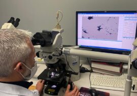 Carcinoma della cervice uterina: nuovo screening molecolare all’Asst di Lecco