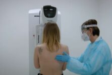 Identificati 717 tumori maligni nel 2024 grazie allo screening oncologico mammografico di ATS Milano