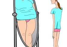 Anoressia nervosa, è donna il 90% dei pazienti