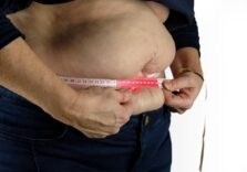 Obesità e peso eccessivo accelerano l’invecchiamento del cervello