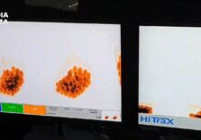 Traffico di eroina a Malpensa, sequestro per 1 milione e 7 arresti