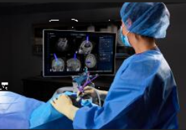 Al Besta di Milano eseguita la prima procedura craniale al mondo per l’asportazione di un tumore cerebrale con il sistema chirurgico Medtronic Stealth AXiS™